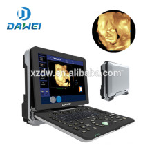 DW-C300 High-End-tragbare 4D Doppler-Ultraschallgerät